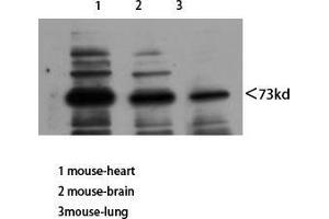 Western Blot (WB) analysis of Mouse Heart Mouse Brain Mouse Lung using Neuregulin-3 Polyclonal Antibody diluted at 1:800. (Neuregulin 3 抗体  (Internal Region))