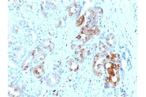 Immunohistochemistry (IHC) image for anti-Ferritin, Light Polypeptide (FTL) (AA 38-165) antibody (ABIN6939459)