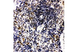 Anti-Nucleophosmin antibody, IHC(P) IHC(P): Rat Spleen Tissue (NPM1 抗体  (N-Term))