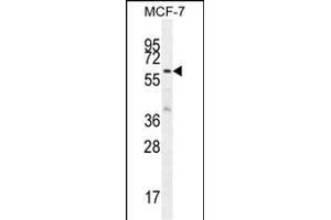 KARS Antibody (N-term) (ABIN655049 and ABIN2844677) western blot analysis in MCF-7 cell line lysates (35 μg/lane). (KARS 抗体  (N-Term))