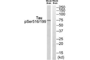 Western blot analysis of extracts from Mouse brain cells, using Tau (Phospho-Ser516/199) antibody. (MAPT 抗体  (pSer199, pSer516))