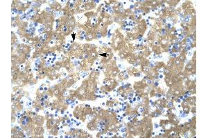 ACAT2 antibody was used for immunohistochemistry at a concentration of 4-8 ug/ml to stain Hepatocytes (arrows) in Human liver. (ACAT2 抗体)