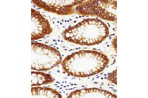 Paraformaldehyde-fixed, paraffin embedded human stomach tissue, Antigen retrieval by boiling in sodium citrate buffer (pH6. (Calpain 2 抗体)