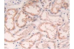 Detection of IL4 in Human Kidney Tissue using Polyclonal Antibody to Interleukin 4 (IL4) (IL-4 抗体  (AA 25-153))