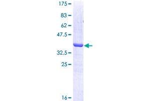 Image no. 1 for GTPase Kras (KRAS) (AA 16-125) protein (GST tag) (ABIN1308935) (K-RAS Protein (AA 16-125) (GST tag))