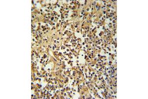 GZ Antibody (Center) (ABIN390763 and ABIN2841021) IHC analysis in formalin fixed and paraffin embedded human lymph tissue followed by peroxidase conjugation of the secondary antibody and DAB staining. (GZMM 抗体  (AA 84-113))