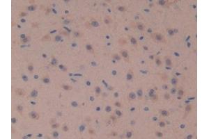 Detection of SOSTDC1 in Mouse Brain Tissue using Polyclonal Antibody to Sclerostin Domain Containing Protein 1 (SOSTDC1) (SOSTDC1 抗体  (AA 24-206))