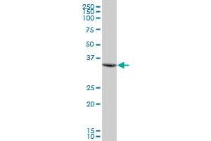 PTPLAD1 MaxPab polyclonal antibody. (PTPLAD1 抗体  (AA 1-362))