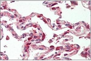 Human Lung: Formalin-Fixed, Paraffin-Embedded (FFPE) (TSC22D1 抗体  (N-Term))