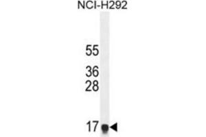 Western Blotting (WB) image for anti-Hepatocellular Carcinoma, Down-Regulated 1 (HEPN1) antibody (ABIN2995879) (HEPN1 抗体)