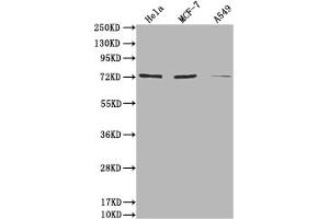 Western Blot Positive WB detected in: Hela whole cell lysate, MCF-7 whole cell lysate, A549 whole cell lysate All lanes: SAMHD1 antibody at 1:2000 Secondary Goat polyclonal to rabbit IgG at 1/50000 dilution Predicted band size: 73, 64, 69 kDa Observed band size: 73 kDa (SAMHD1 抗体  (AA 1-314))