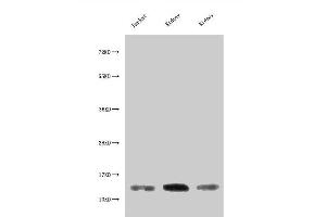 Western Blot Positive WB detected in: Jurkat whole cell lysate, Rat kidney tissue, Mouse kidney tissue All lanes: MIF antibody at 3 μg/mL Secondary Goat polyclonal to rabbit IgG at 1/50000 dilution Predicted band size: 13 kDa Observed band size: 13 kDa (MIF 抗体  (AA 2-115))