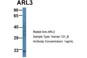 Host: Rabbit Target Name: ARL3 Sample Type: Human 721_B Antibody Dilution: 1. (ARL3 抗体  (N-Term))