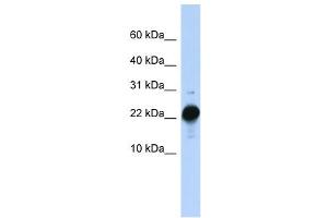 CSHL1 antibody used at 1 ug/ml to detect target protein. (CSHL1 抗体  (C-Term))