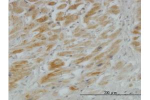 Image no. 5 for anti-Hedgehog Interacting Protein (HHIP) (AA 21-121) antibody (ABIN466235) (HHIP 抗体  (AA 21-121))