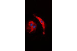 Immunofluorescent analysis of Collagen 5 alpha 3 staining in HuvEc cells.