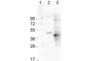 Western Blot using  Immunochemicals' Mouse Anti-6x-His Epitope Tag Monoclonal Antibody showing detection of the 6xHis sequence on N-terminally-tagged (lane 2) and C-terminally-tagged recombinant proteins (lane 3).