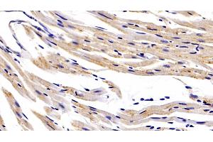 Detection of HIF1a in Mouse Cardiac Muscle Tissue using Polyclonal Antibody to Hypoxia Inducible Factor 1 Alpha (HIF1a)