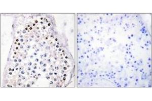 Immunohistochemistry analysis of paraffin-embedded human testis tissue, using HOXA1/B1/D1 Antibody. (HOXA1/B1/D1 抗体  (AA 216-265))