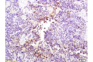 Formalin-fixed and paraffin embedded mouse spleen labeled with Anti-CD335/NKp46/NCR1 Polyclonal Antibody, Unconjugated (ABIN1386154) at 1:200 followed by conjugation to the secondary antibody and DAB staining (NCR1 抗体  (AA 198-206))