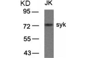 Image no. 3 for anti-Spleen tyrosine Kinase (SYK) (AA 321-325) antibody (ABIN319416) (SYK 抗体  (AA 321-325))