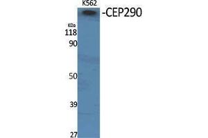 Western Blotting (WB) image for anti-Centrosomal Protein 290kDa (CEP290) (Internal Region) antibody (ABIN3174343) (CEP290 抗体  (Internal Region))