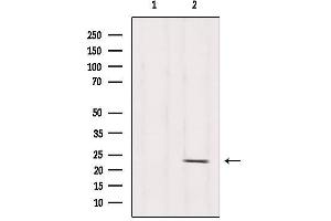Western blot analysis of extracts from Hela, using RPS5 Antibody. (RPS5 抗体  (Internal Region))