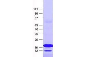 Western Blotting (WB) image for Nudix (Nucleoside Diphosphate Linked Moiety X)-Type Motif 6 (NUDT6) protein (His tag) (ABIN2727775)