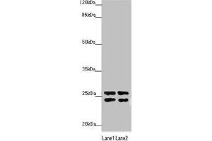 Western blot All lanes: GRPEL1 antibody at 2. (GRPEL1 抗体  (AA 1-217))