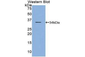Western Blotting (WB) image for anti-Caspase Recruitment Domain Family, Member 9 (CARD9) (AA 274-530) antibody (ABIN1858233) (CARD9 抗体  (AA 274-530))