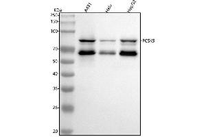 Western blot analysis of PCSK9 using anti-PCSK9 antibody (ABIN7605881).