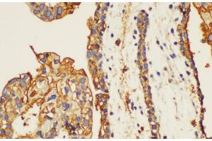 Immunohistochemistry of paraffin-embedded Human placenta using ANXA5 Ployclonal Antibody at dilution of 1:100. (Annexin V 抗体)