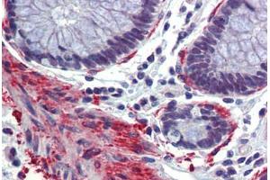Colon, Human: Formalin-Fixed, Paraffin-Embedded (FFPE) (CBP 抗体  (AA 144-193))