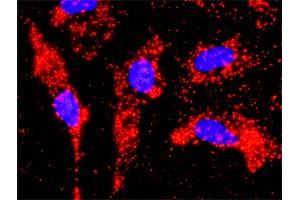 Proximity Ligation Analysis of protein-protein interactions between TP53 and PIAS1. (PIAS1 抗体  (AA 543-651))