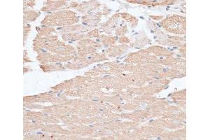 Immunohistochemistry of paraffin-embedded Rat heart using ABCC5 Polyclonal Antibody at dilution of 1:100 (40x lens). (ABCC5 抗体)