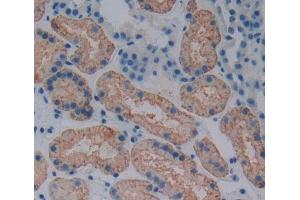 Used in DAB staining on fromalin fixed paraffin- embedded kidney tissue (ABCB6 抗体  (AA 590-842))