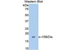 Western Blotting (WB) image for anti-Leukemia Inhibitory Factor Receptor alpha (LIFR) (AA 151-290) antibody (ABIN1173144) (LIFR 抗体  (AA 151-290))