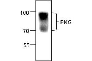 Image no. 1 for anti-Protein Kinase, CGMP-Dependent, Type I (PRKG1) (N-Term) antibody (ABIN127130) (PRKG1 抗体  (N-Term))
