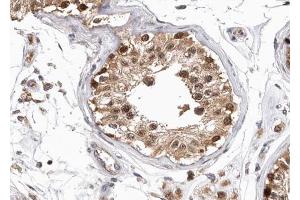 ABIN6268750 at 1/100 staining human testis tissue sections by IHC-P. (Patched 1 抗体)
