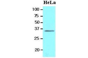 Cell lysates of HeLa(20 ug) were resolved by SDS-PAGE, transferred to nitrocellulose membrane and probed with anti-human BRCC36 (1:1000). (BRCC3 抗体  (AA 1-316))
