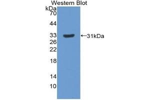 Detection of Recombinant PXN, Rat using Polyclonal Antibody to Paxillin (PXN) (Paxillin 抗体  (AA 327-568))