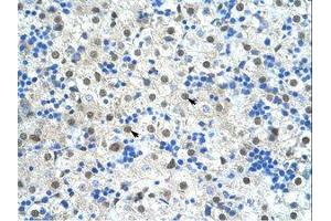 Image no. 1 for anti-Pre-mRNA Branch Site Protein p14 (SF3B14) (N-Term) antibody (ABIN203323) (Pre-mRNA Branch Site Protein p14 (SF3B14) (N-Term) 抗体)