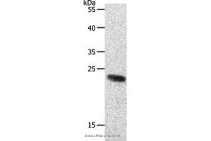 Western blot analysis of 231 cell, using RAMP2 Polyclonal Antibody at dilution of 1:650 (RAMP2 抗体)