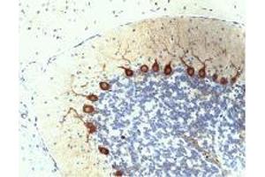 Purkinje Cells in rat cerebellum, formalin-fixed paraffin-embedded tissue, citrate pre-treatment, 40X. (PKC delta 抗体  (AA 114-289))