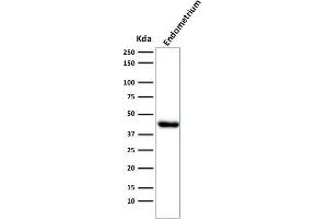Western Blot Analysis of Endometrium muscle tissue lysate using Muscle Specific Actin Mouse Monoclonal Antibody (HHF35). (ACTA1/ACTA2A/ACTG2 抗体)