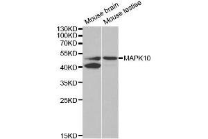 Western blot analysis of extracts of various cell lines, using MAPK10 antibody. (MAPK10 抗体  (AA 175-464))