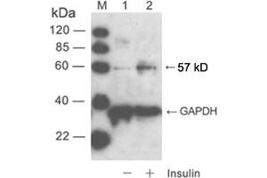 Western blot analysisLane 1: cell lysate of NIH/3T3 unstimulatedLane 2: cell lysate of NIH/3T3 stimulated with insulinPrimary Antibody: Rabbit Anti-Akt (Phospho-Ser473) Polyclonal Antibody (ABIN398632) Secondary Antibody: 0. (AKT1 抗体  (pSer473))