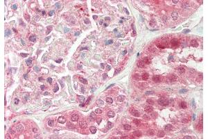 Rabbit Anti-TSC22D1 antibody Catalog Number: ARP36279 Formalin Fixed Paraffin Embedded Tissue: Human Kidney Primary antibody Concentration: 1:100 Secondary Antibody: Donkey anti-Rabbit-Cy3 Secondary Antibody Concentration: 1:200 Magnification: 20x Exposure Time: 0. (TSC22D1 抗体  (C-Term))