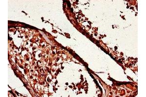 Immunohistochemistry of paraffin-embedded human testis tissue using ABIN7174080 at dilution of 1:100 (YES1 抗体  (AA 1-155))