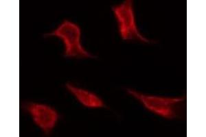ABIN6267292 staining MDA-MB-435 by IF/ICC. (p53 抗体  (pSer366))
